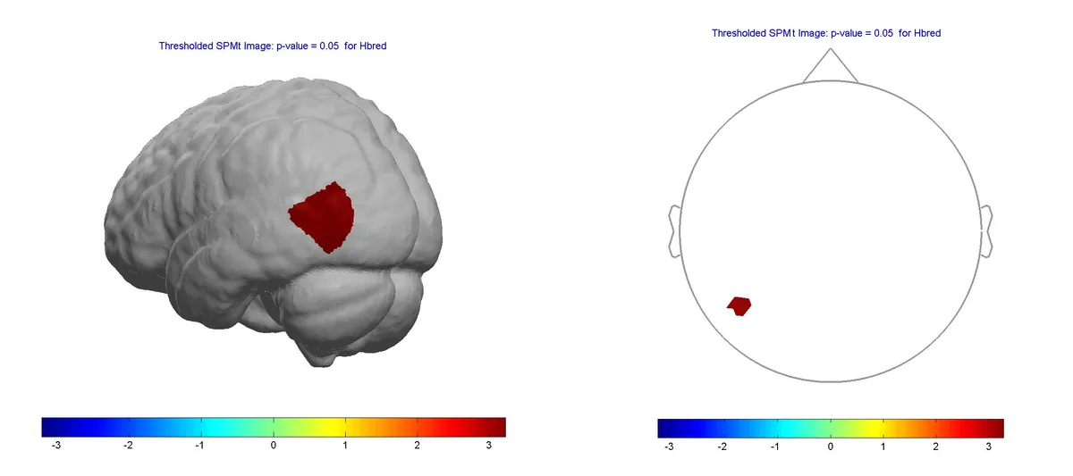 BrAIn Jam