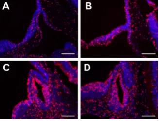 Foxd1 Is Necessary for Pituitary LH Expression