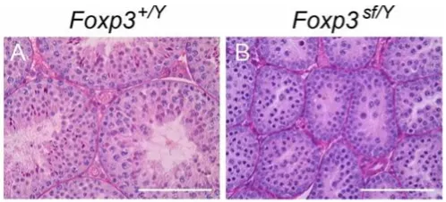 FOXP3: A Critical Role in Fertility in Mice