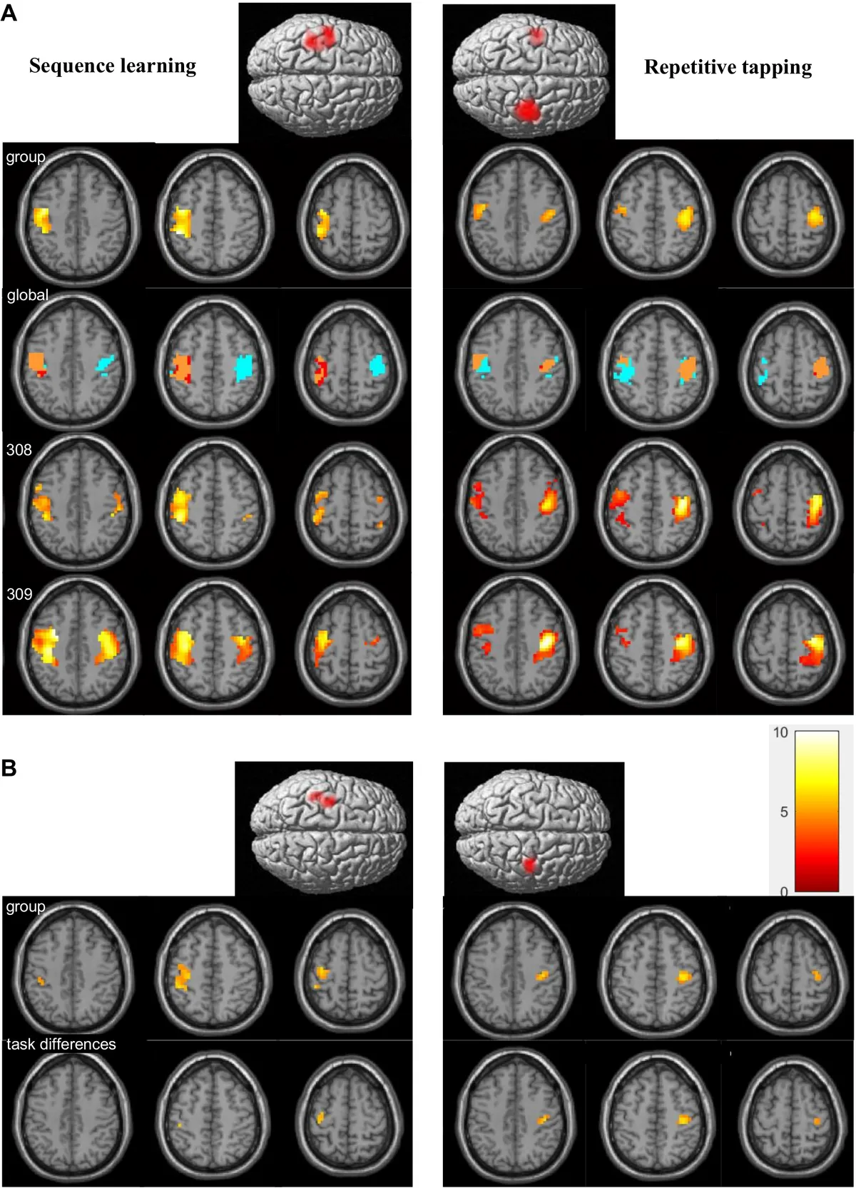 Hippocampal Connectivity: Laterality and Motor Learning